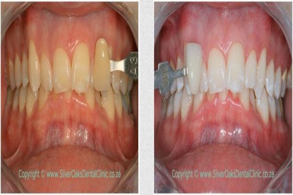 Silver Oaks Dental Clinic