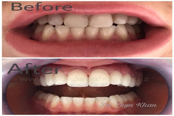 Hyde Park Dentist