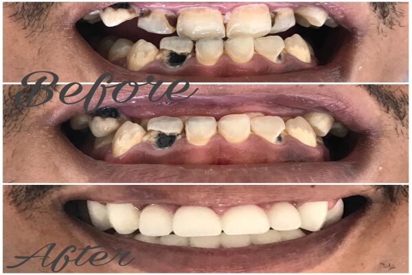 Hyde Park Dentist