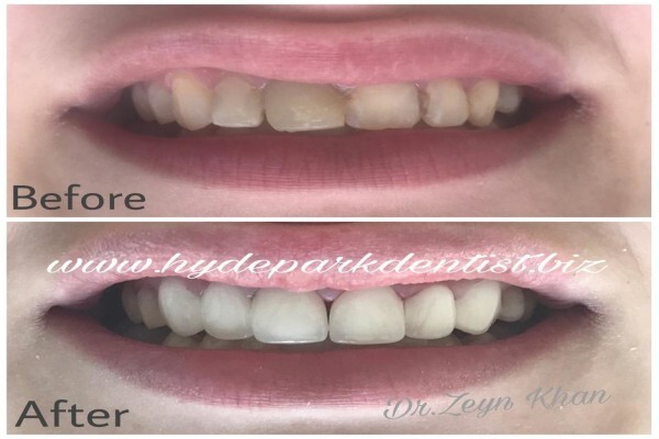 Hyde Park Dentist