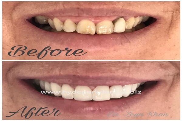 Hyde Park Dentist