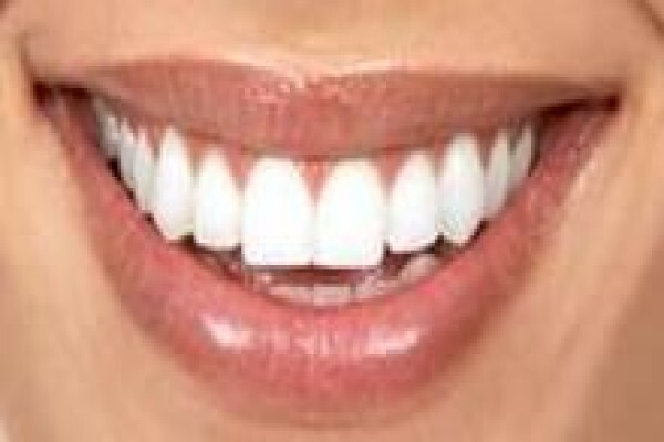 Hyde Park Dentist