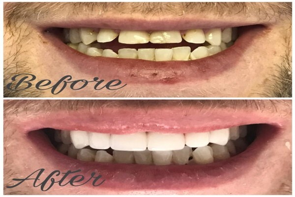 Hyde Park Dentist