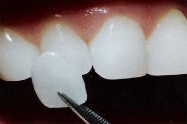 Hyde Park Dentist