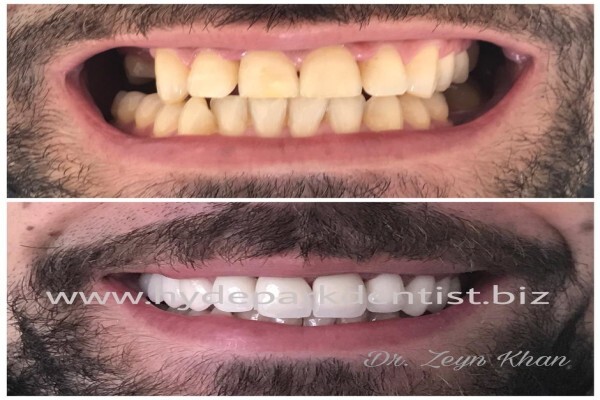 Hyde Park Dentist