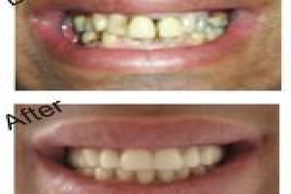 Hyde Park Dentist