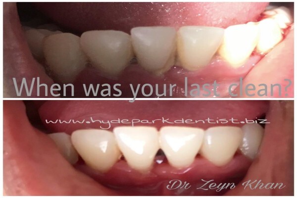 Hyde Park Dentist