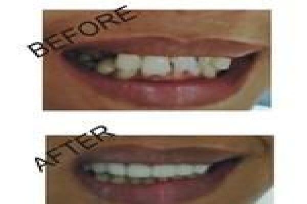 Hyde Park Dentist