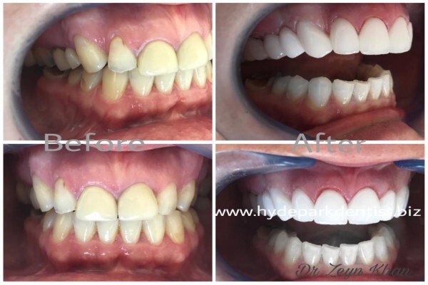 Hyde Park Dentist