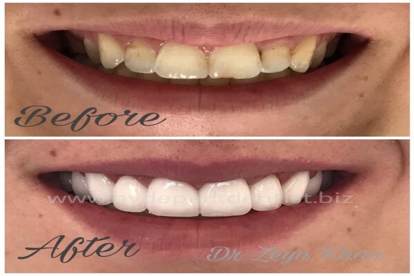 Hyde Park Dentist