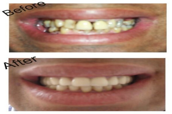 Hyde Park Dentist