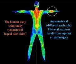 Thermoscan