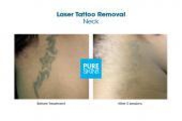 The Laser Body Shop