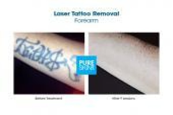 The Laser Body Shop