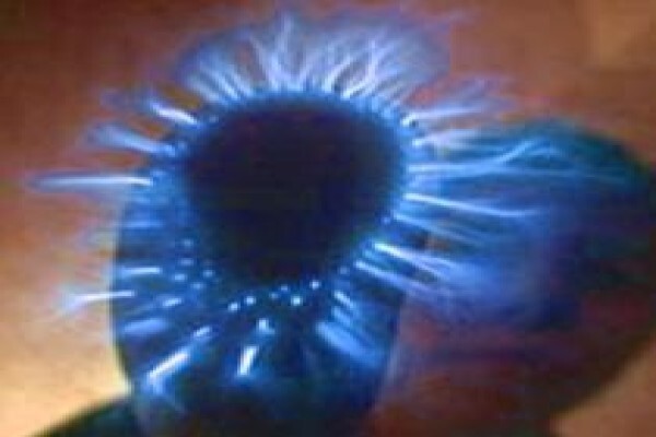 Scio Therapy And Quantum Healing