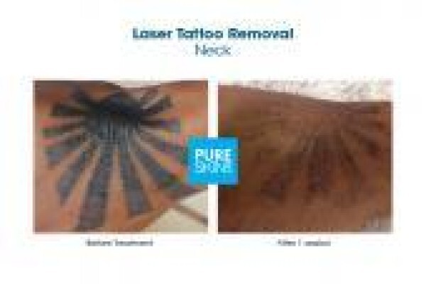 The Laser Body Shop