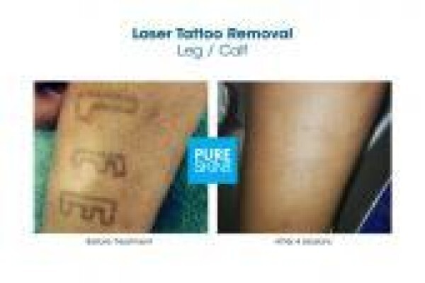 The Laser Body Shop