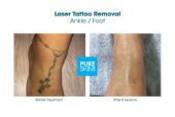 The Laser Body Shop