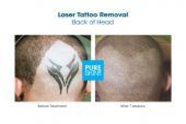 The Laser Body Shop