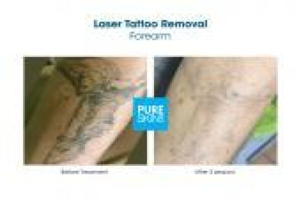 The Laser Body Shop