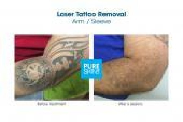 The Laser Body Shop
