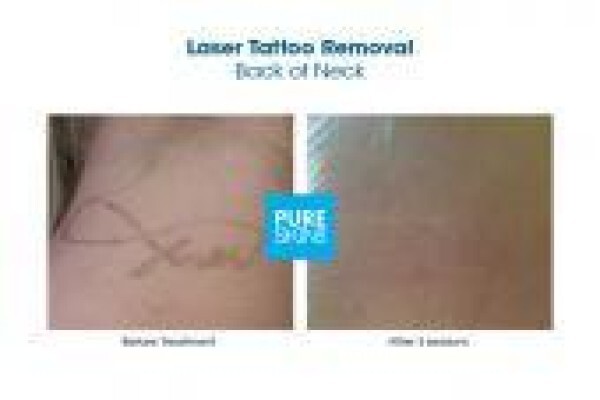 The Laser Body Shop