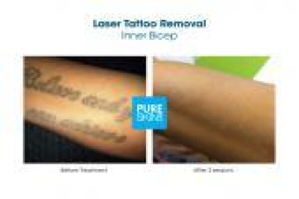 The Laser Body Shop