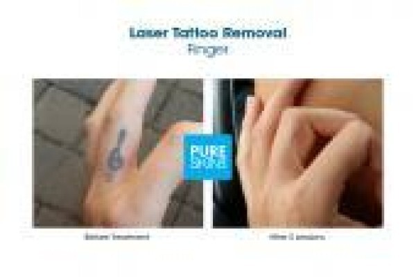 The Laser Body Shop