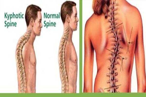 Improved Postural Alignment For You (Ipa4U)