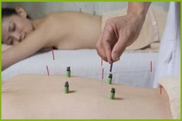 Going Green Acupuncture