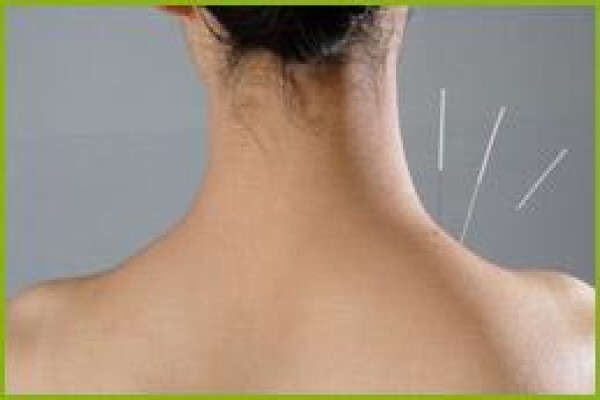 Going Green Acupuncture