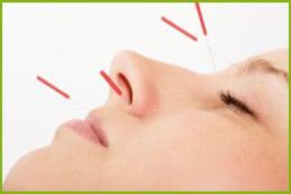 Going Green Acupuncture