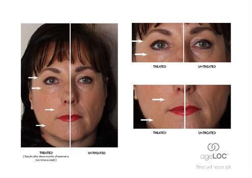 Anti Aging Secrets