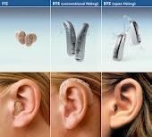 Nhc Northcliff Audiology Hearing Aids