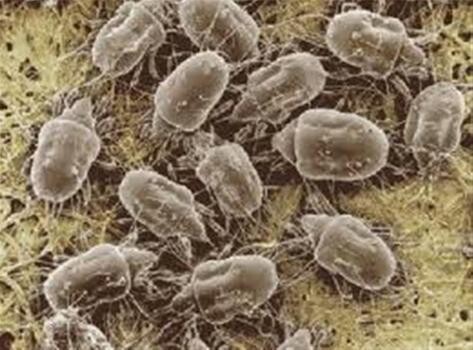 Zenclean Dustmite Doctor