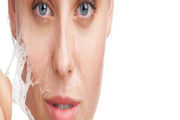 Psoriasis
