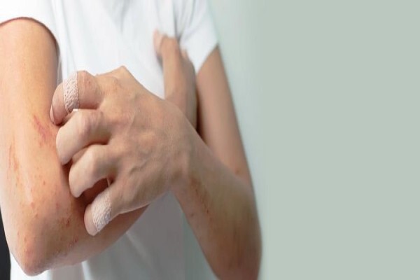 Advanced Dermatology