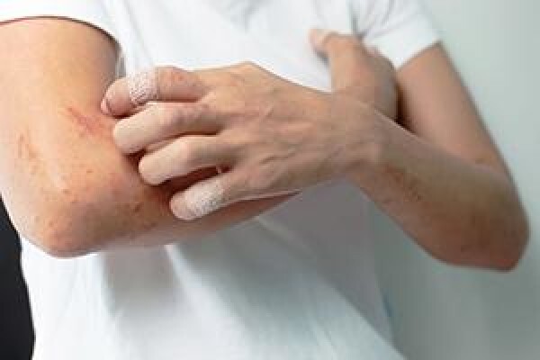 Advanced Dermatology