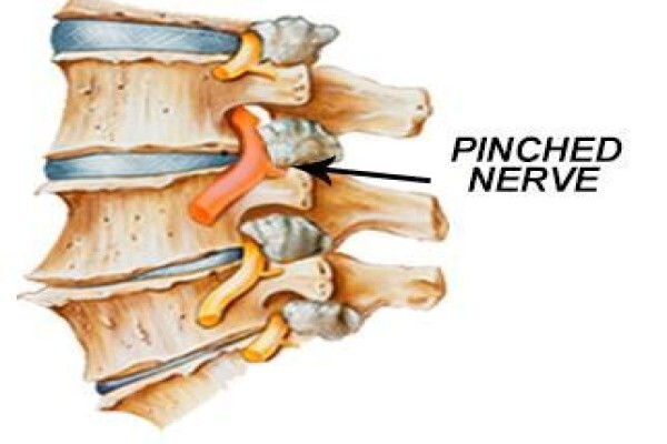 Chiropractor Sandton Sandown Dr Julia Meyer