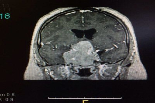 Dr Deon Lamprecht