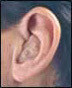Hearing Aids South Africa Hmcs