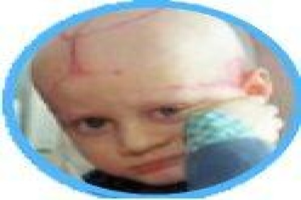 Cancer Kids