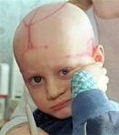 Cancer Kids