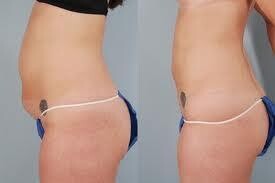H2O Body Xperience