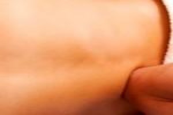 Massage At Newagetherapies Cape Town Cbd