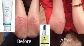 Independent Aloe Vera Flp Distributor