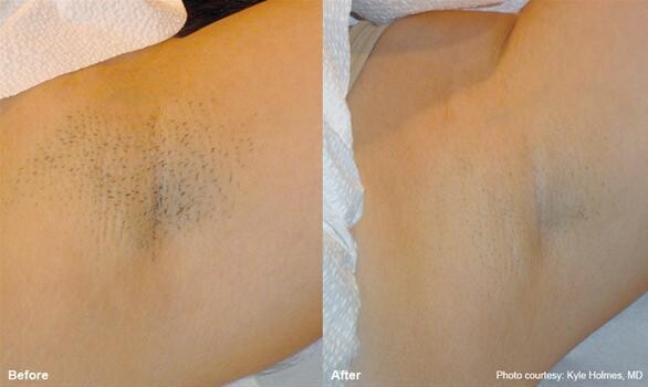 The Laser Beautique - Pretoria