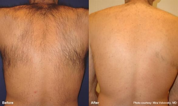 The Laser Beautique - Pretoria