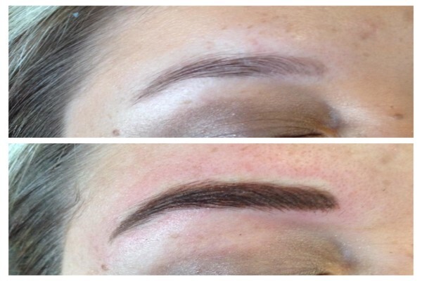 Endermologie Claremont