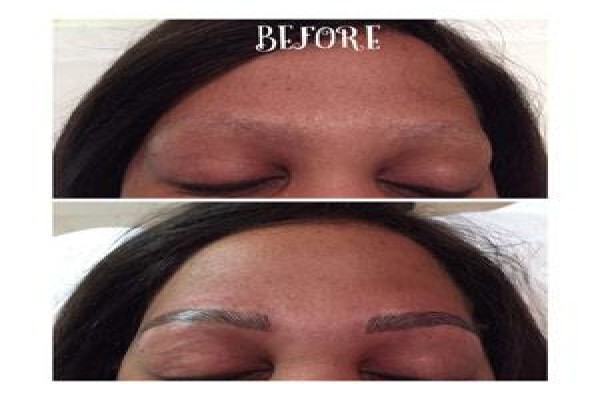 Endermologie Claremont